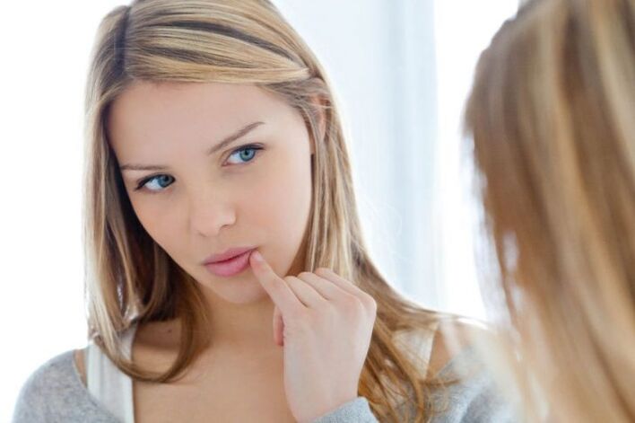 warts on the lips of girls how to get rid of them
